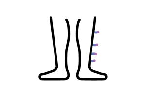 Icono que muestra crecimiento anómalo del vello