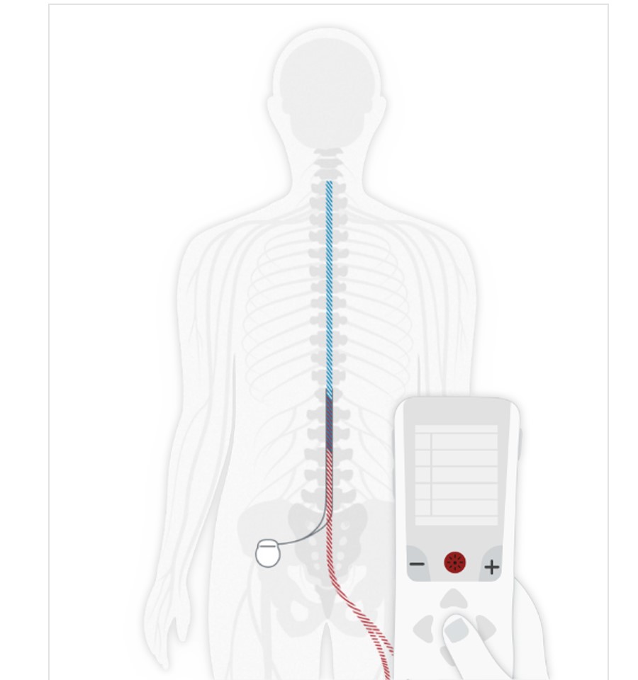 Ilustraciones que muestran cómo actúa la EME en el cuerpo