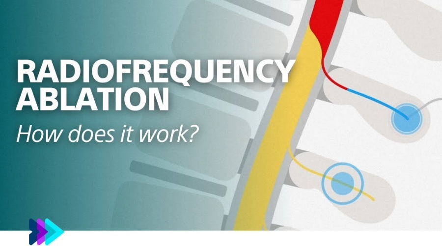 En este vídeo se explica la AFR y algunos de los beneficios que este procedimiento puede aportar.